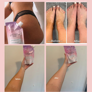 Glow - Be - Gone Bundle - GlowDry Australia